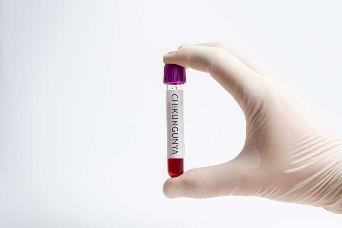 Provetta di sangue con chikungunya